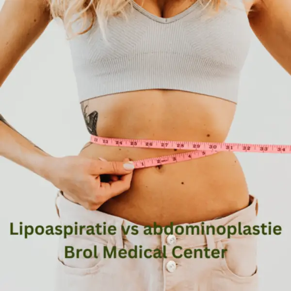 Liposculptura cu laser vs abdominoplastie